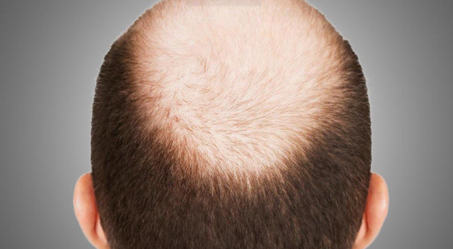 人活多久看头发能知道？医生提醒：寿命长的人，头发常有这些特征