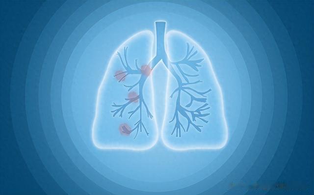 一淤生百病，送你4个中成药，活血化瘀，百病不侵！