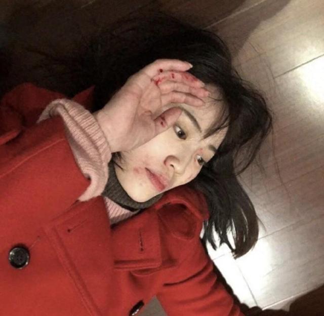 38岁马蓉晒移民后生活,头发稀疏没了精气神