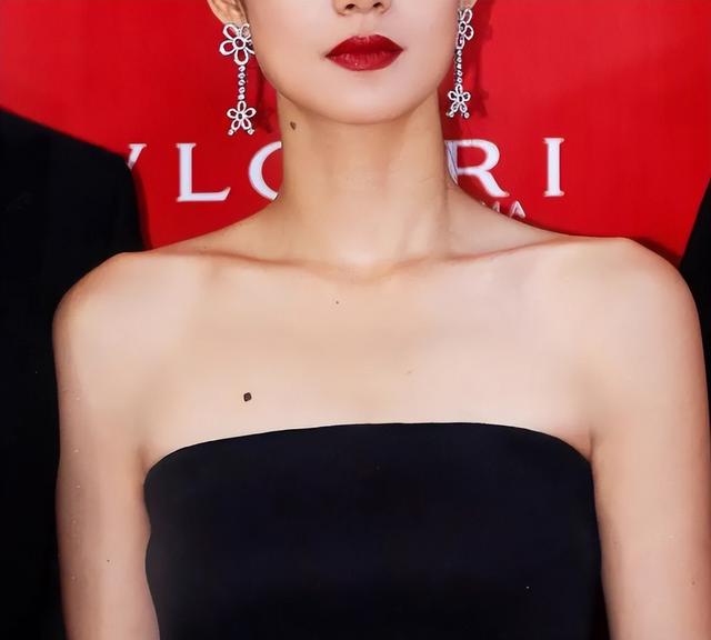 再三提醒：长在9个部位的痣，与癌症“密不可分”，及时处理