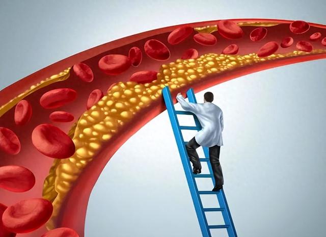 橙子是高血脂的“催化剂”？医生建议：降血脂，忌口3果，多吃3菜