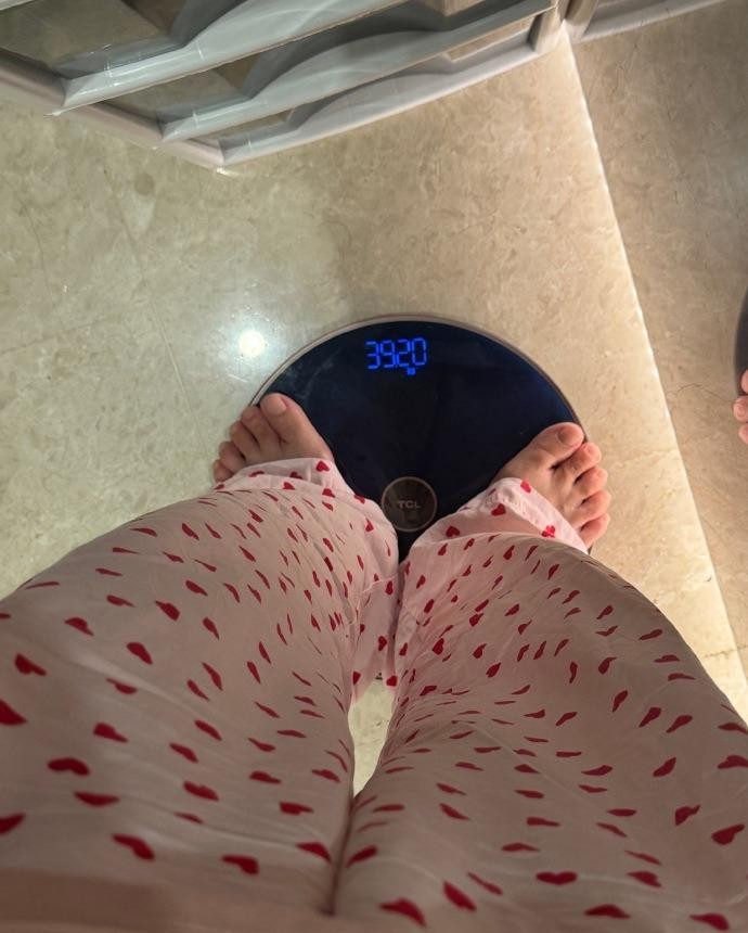 杜淳老婆多次增肥失败，确诊罕见综合症，当前体重不足80斤