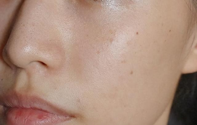 告别暗沉黄气,这些护肤秘诀要记牢!