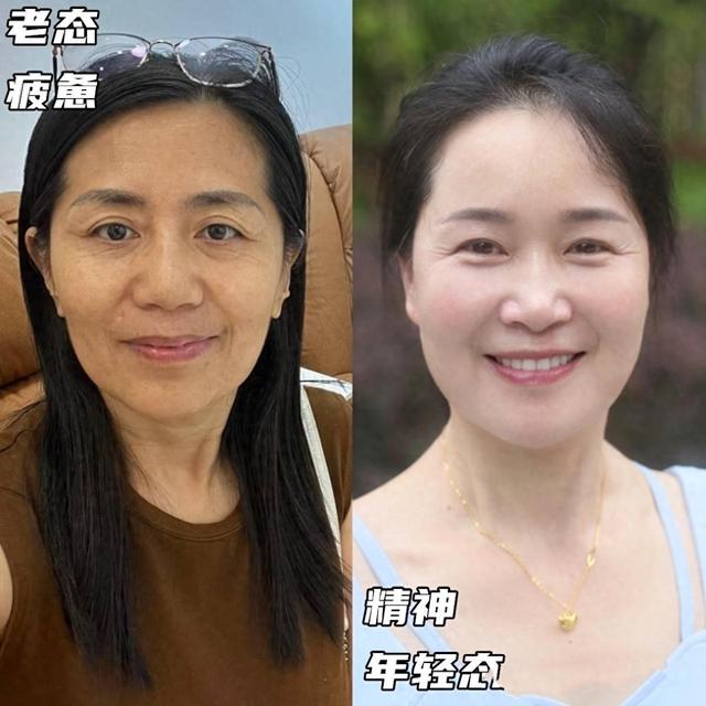 “耐老”长相, 脸上都有这些特征,高级还很气质,抗老效果很明显