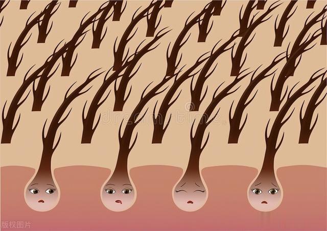 摸到头皮有疙瘩、脓包，可能是什么病？逃不开这4种