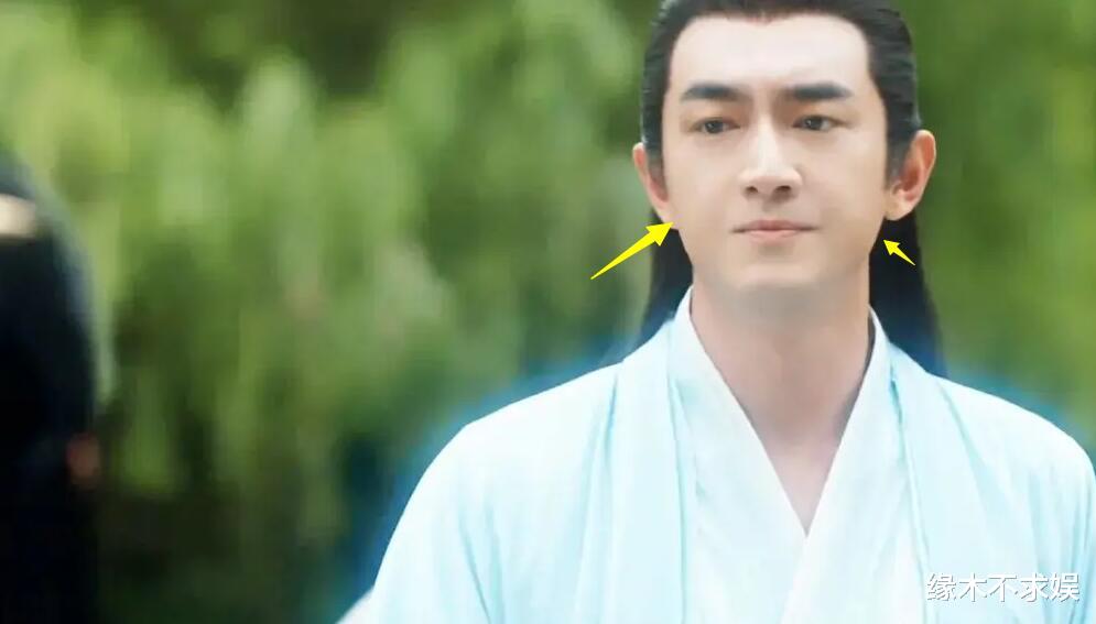 36岁林更新被偶遇，瘦到脱相认不出，腿上全是伤显病态！