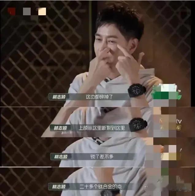 林志颖看起来又老又年轻，像一个老了的年轻人，感觉怪怪的~