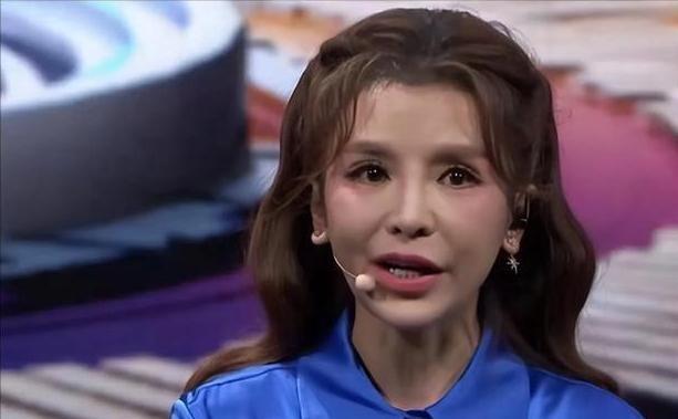 朱迅被疑整容失败大变样嘴歪脸僵撞脸宋小宝，健康状况引担忧