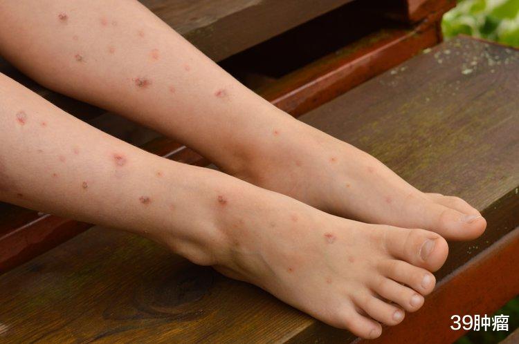 糖尿病人出现6种情况，必须马上住院，否则生命可能有危险