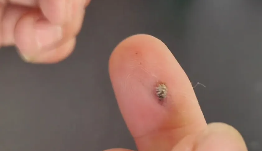 粉条里有没有明胶,打火机烧一烧就知道,学会再也不会买到假粉条