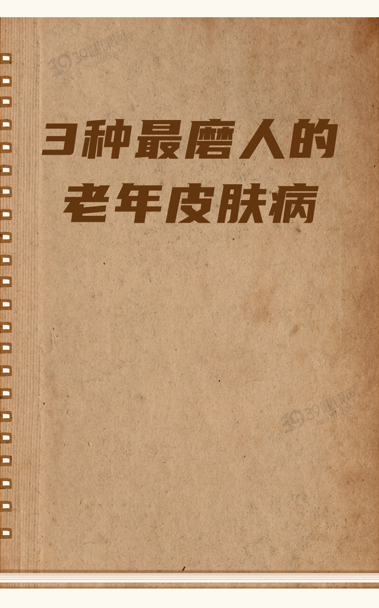 皮肤瘙痒、长疙瘩别不在意，这3种皮肤病在“兴风作浪”