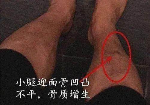 肾精足不足，敲敲迎面骨便知