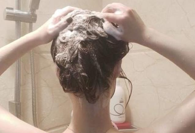 郑爽近照曝光,身体发福头发稀疏!网友:怎么脱发成这样?!