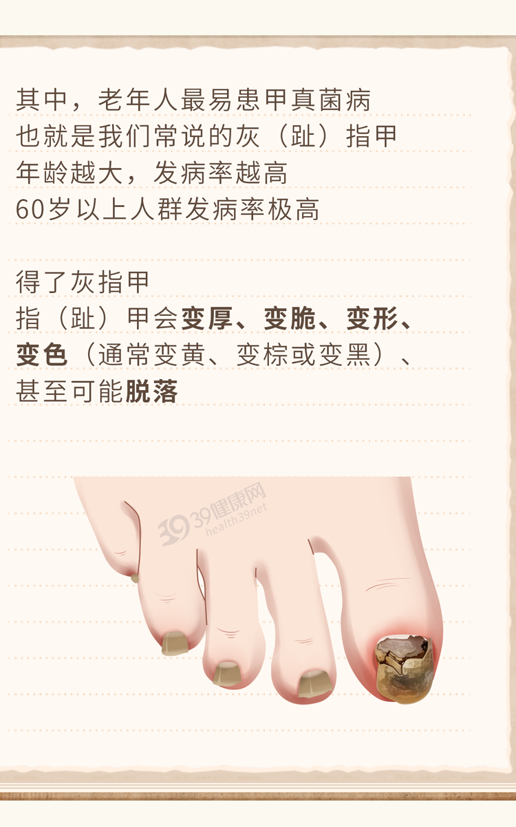 皮肤瘙痒、长疙瘩别不在意，这3种皮肤病在“兴风作浪”