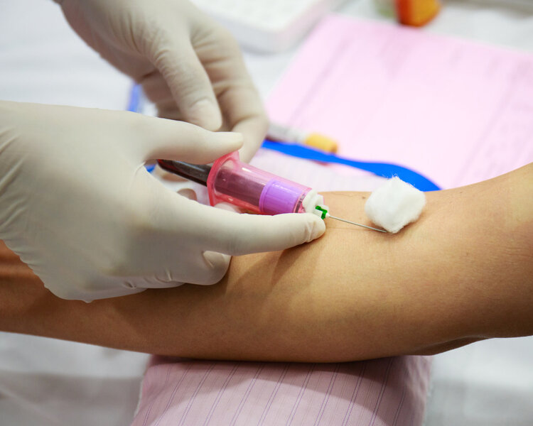 为什么一到医院就要抽血？医生揭秘：抽出来的血，最终都去了哪里