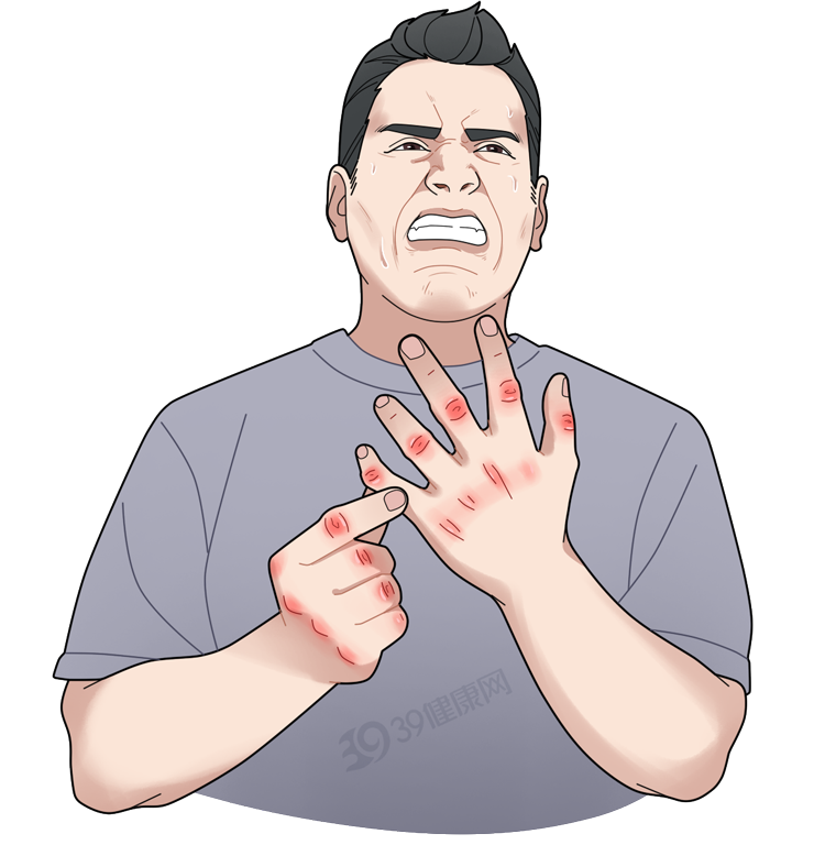 身体癌变，手部先知？提醒：若指甲出现4种异样，警惕是癌变征兆