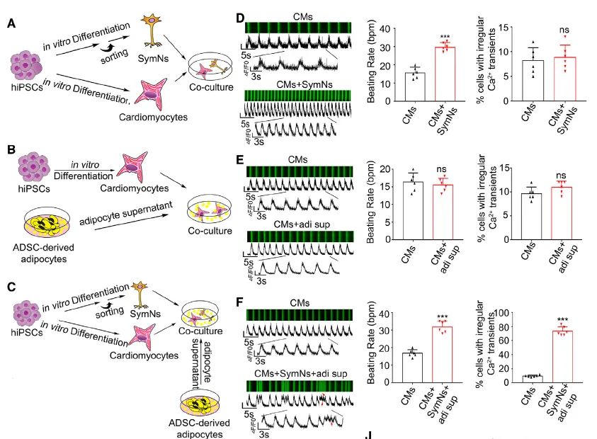揭秘心脏脂肪与心律失常的深层联系：跨学科研究开辟治疗新路径