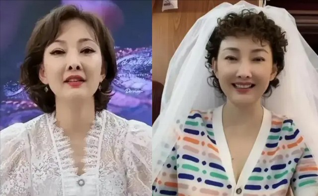 “消失”的小品演员,郭达白发稀疏认不出,牛莉变脸,陈佩斯可惜