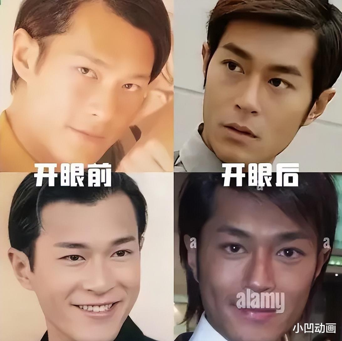 古天乐被网友呼吁停止整容,眼角提升过度引热议,原生态外貌更受青睐