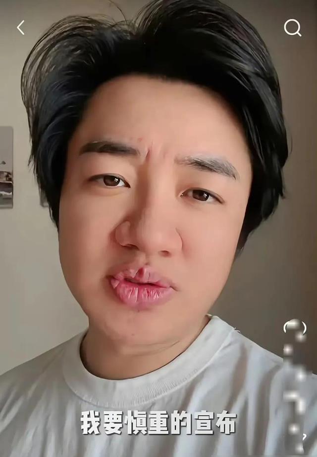 王祖蓝发文称“10年的婚姻要结束了”网友猜中开头没猜中结尾