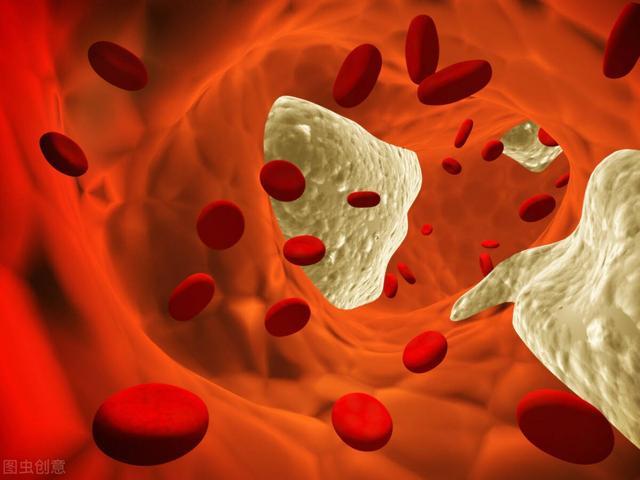 它是“溶栓高手”，每天喝一杯，血管悄悄变干净，很多人不知道