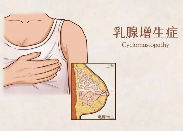 寿命比较短的女性，通常会有4个“共性”，希望你一个也不占