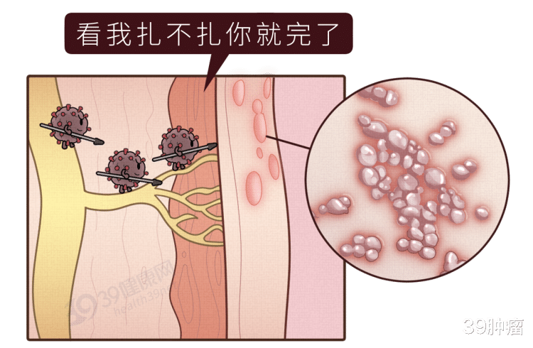 一旦感染终身携带！发作痛不欲生，超90%成人体内潜伏这种病毒