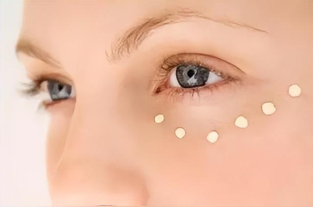 “脂肪粒”是脂肪吗？为你揭秘其真实身份！