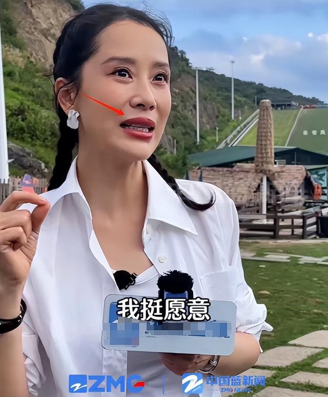 冲上热搜！演员海清陷整容风波：嘟嘟唇、三角鼻，颜值大变引热议
