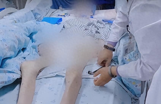 15岁少女极端减肥,50天只喝水不吃饭,妈妈含泪拔掉氧气管