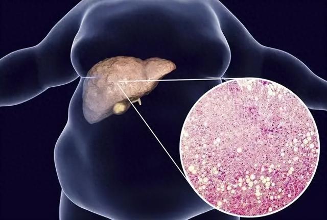 1个肝脏专用方！补足肝血，眼睛好、睡眠好、筋骨好