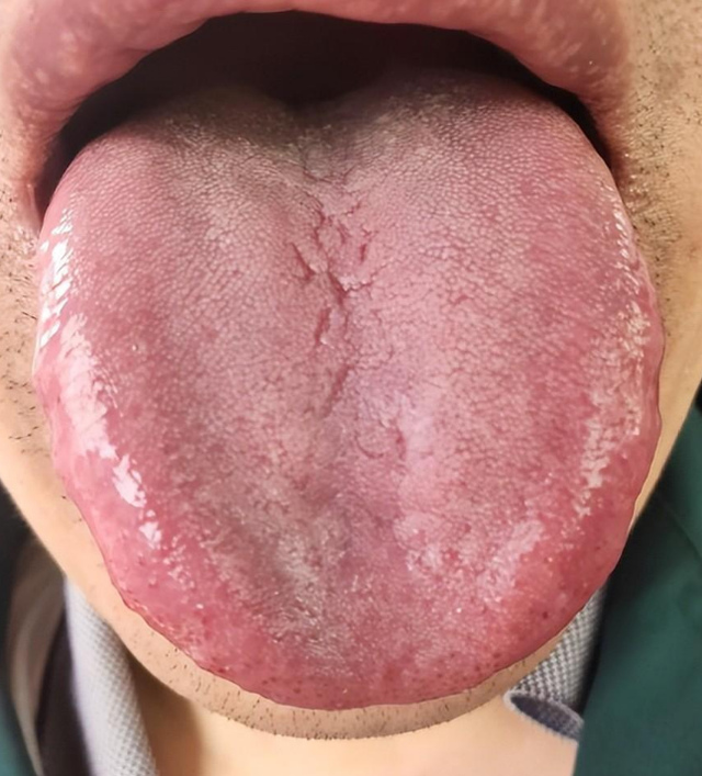 金匮肾气，桂附地黄补阳无效？中医：阳道不通，怎么补都是白搭！