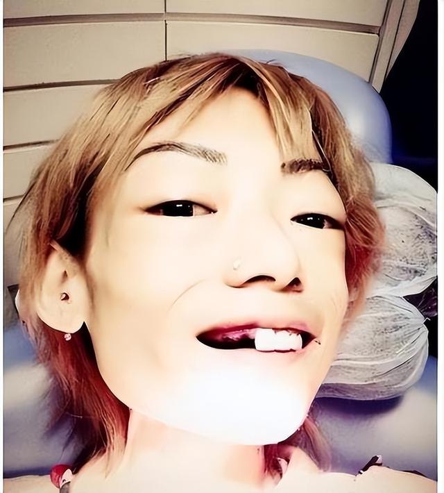 一代女神沦为豪门玩物？结婚8年牙齿全掉，器官切除，面似骷髅