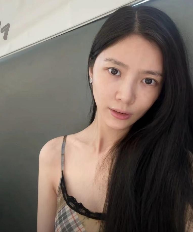 杜淳老婆多次增肥失败，确诊罕见综合症，当前体重不足80斤