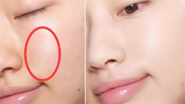 毛孔粗大用什么水乳？真正改善毛孔粗大收缩毛孔的护肤品排行榜