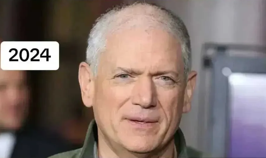 《越狱》主演米帅近照曝光，头发稀松全白满脸沧桑，网友叹青春不再