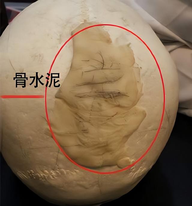 韩国人灌骨水泥，日本人湿头发贴头皮，审美差异竟然如此之大？