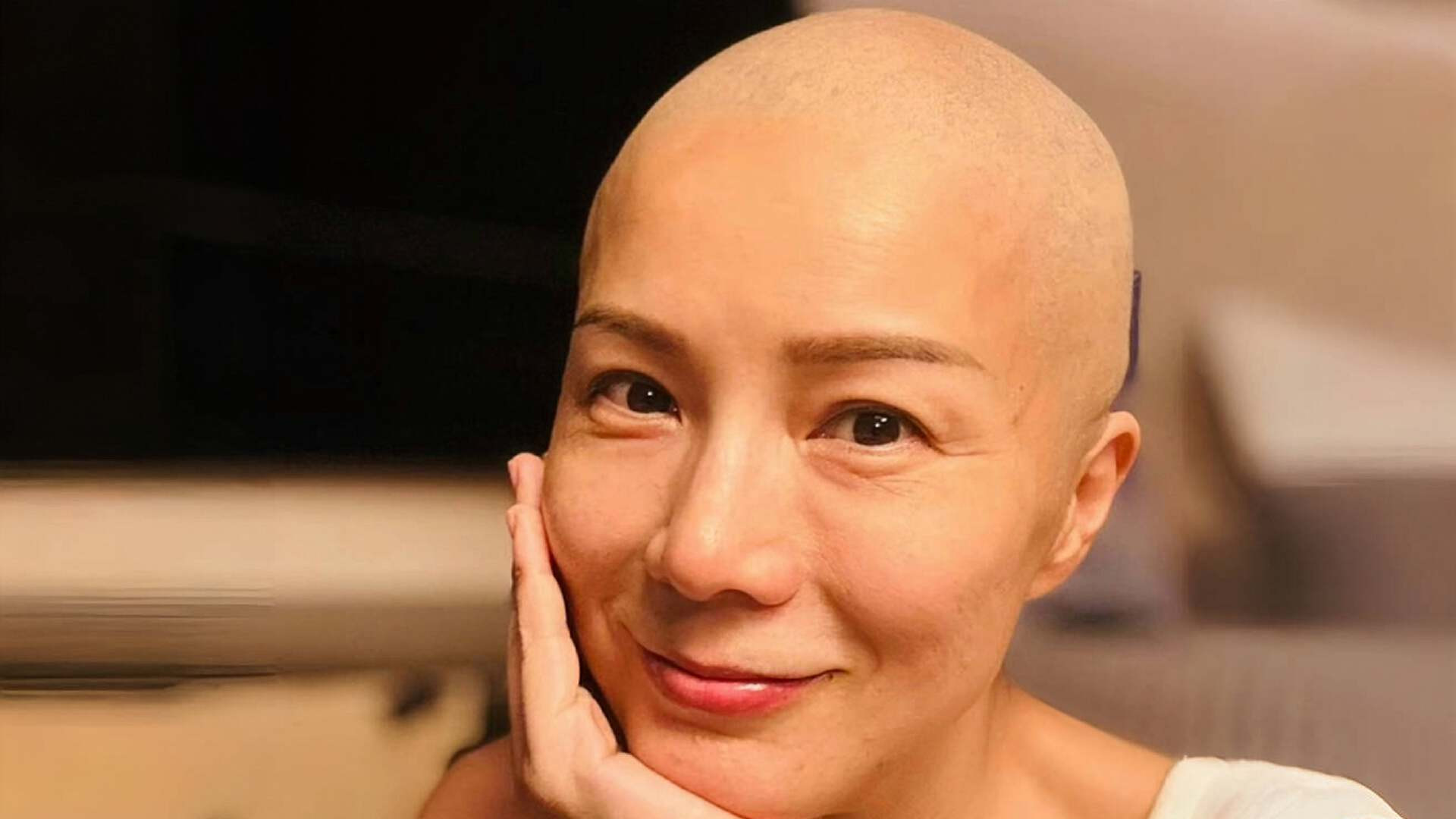 香港知名女星乳癌复发，化疗后掉发剃成光头，已准备好多顶假发