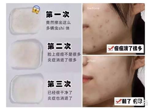 美国已禁用的“剧毒”洗面奶我们还在卖!网友:还不如用清水!