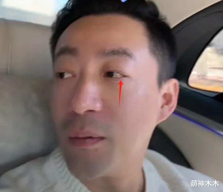 汪小菲求婚成功后首露面,带未婚妻出门溜达,面容憔悴眼底发红