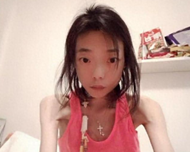 港星\最强恋爱脑\：为挽留丈夫暴瘦到44斤，牙齿掉光，仙女变骷髅