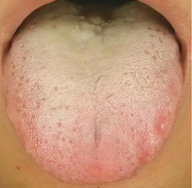 “临阵不挺、见花即谢”补了没用？中医：明白这3点才能重回巅峰