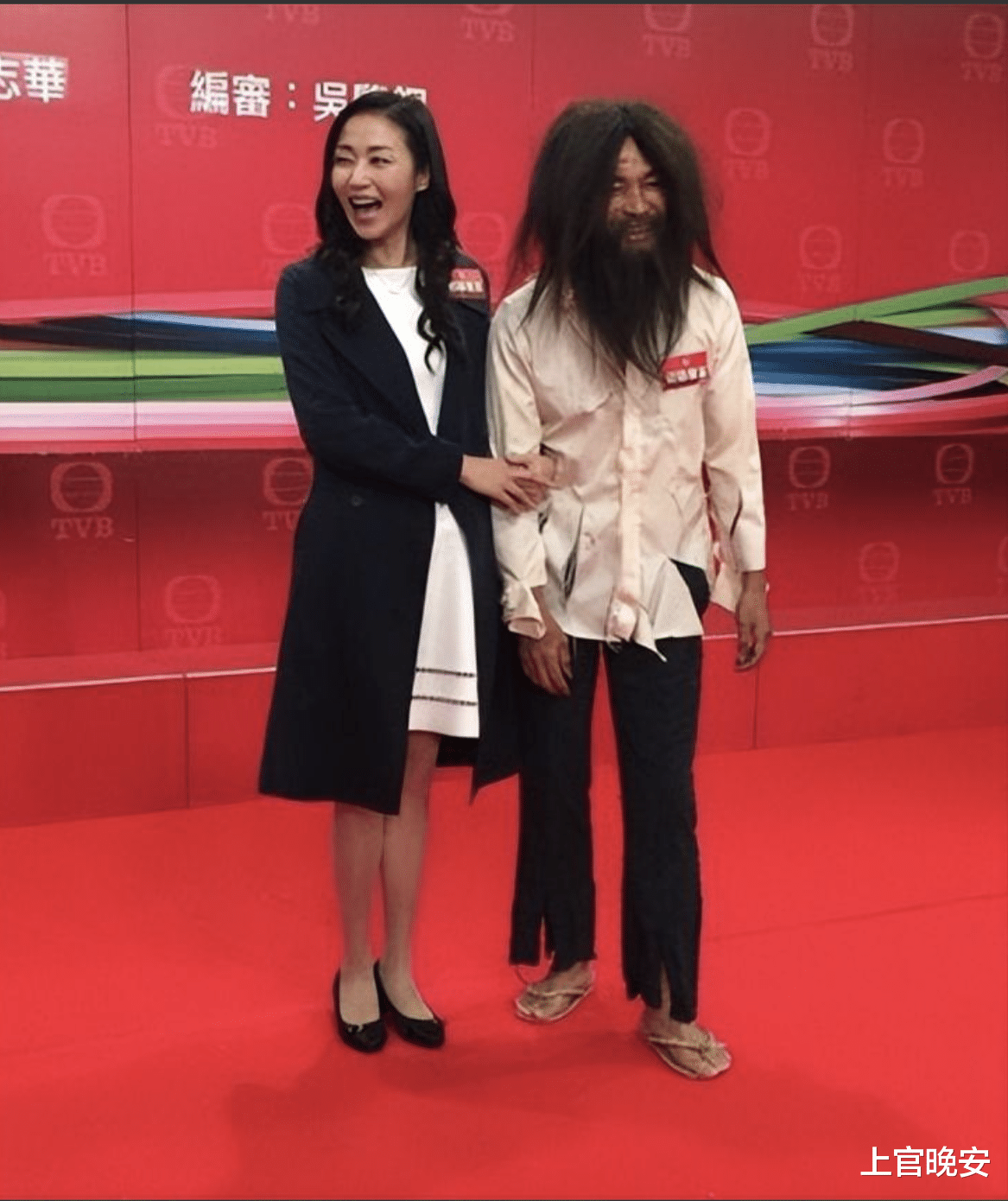 郭晋安又帅回来了！面部自然，不再僵硬似蜡像，网友：终于收手了