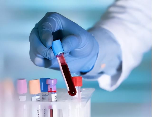 血型决定寿命长短?60万人研究发现:A型血60岁前或更易中风