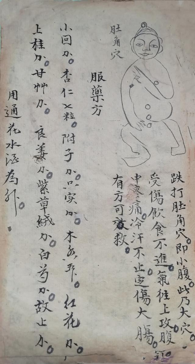 跌打损伤伤穴位秘方古书籍