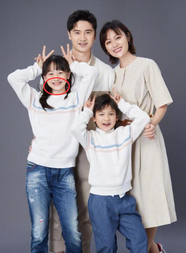 森碟下巴后缩严重恐影响功能,叶一茜被指责,田亮回应:正在矫正