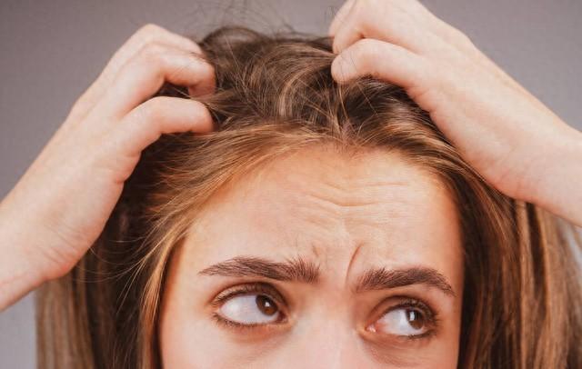 男子用清水洗头,让秃顶变满头黑发,真的管用吗?告诉你真相