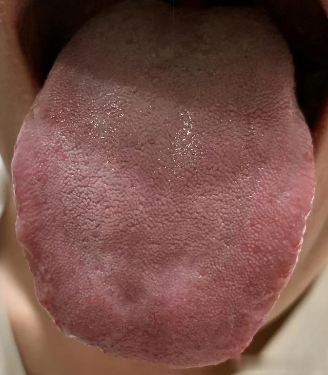 《一秒钟专属方》，脱敏延时，时长越短效果明显