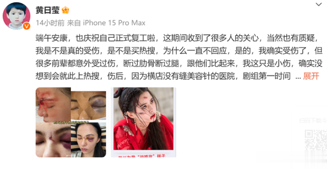 知名演员突发意外!工作人员失误致从高空摔下,表情吃痛一片狼藉