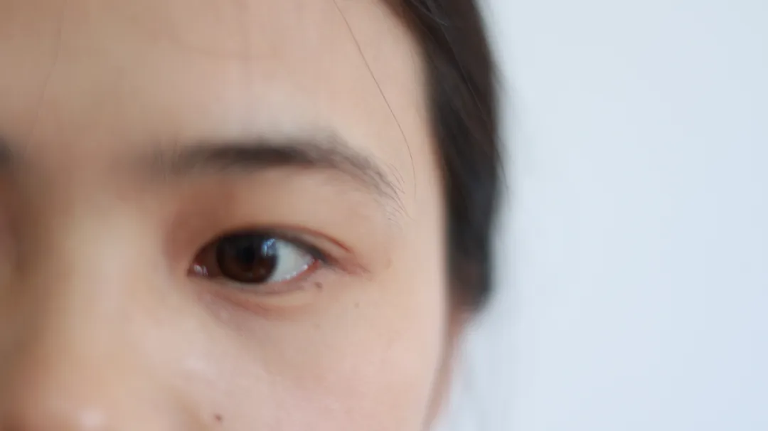 头面部出现这3种迹象，多是肝脏出现了问题，中医提醒：要养肝了